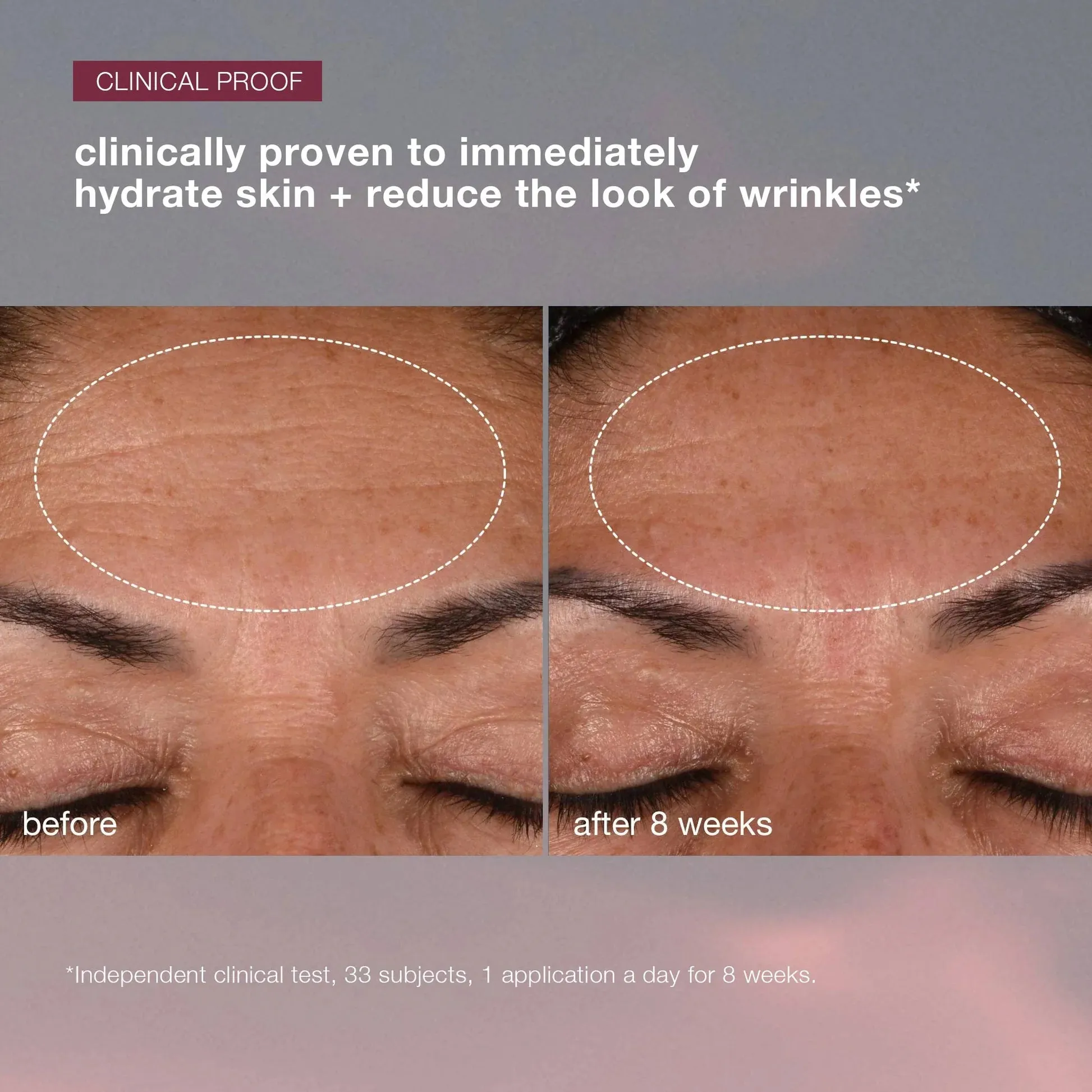 dynamic skin recovery spf 50 moisturizer