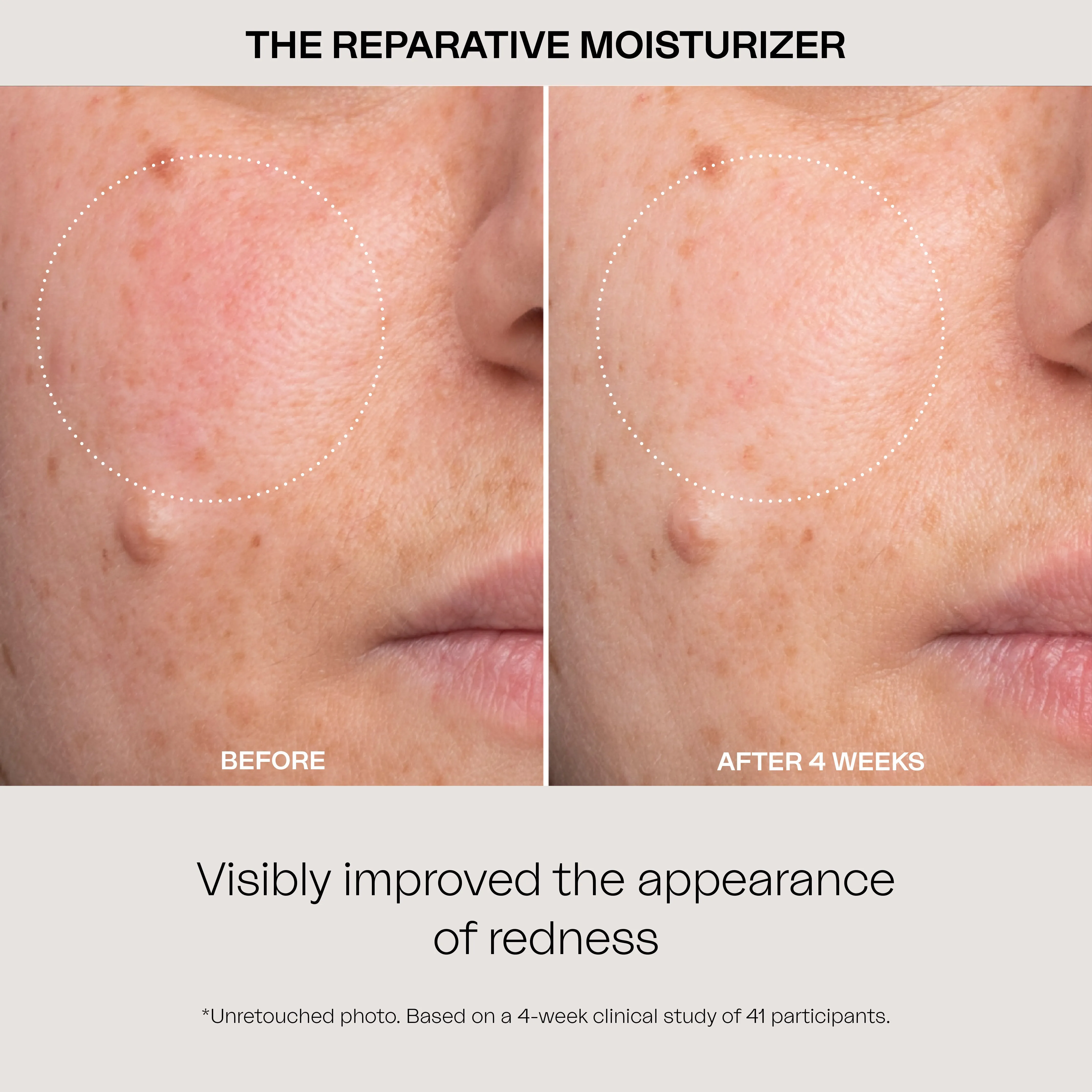 The Reparative Moisturizer